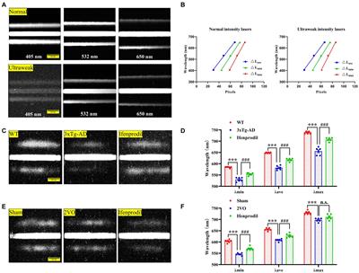 Reduced biophotonic activities and spectral blueshift in Alzheimer’s disease and vascular dementia models with cognitive impairment